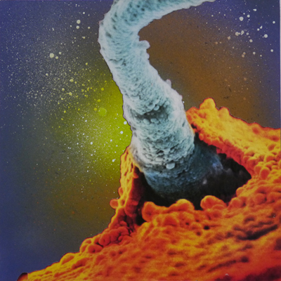 sperm